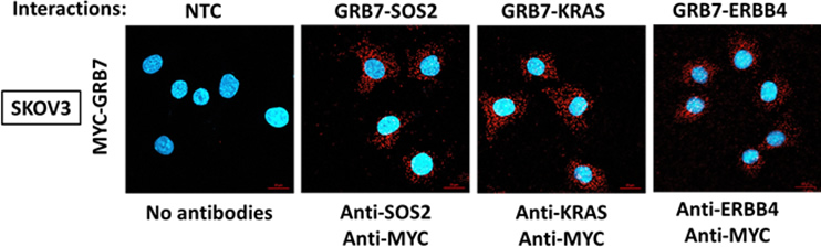 The interactions of GRB7 and other partners (SOS2, KRAS and ERBB4) are showed by using in situ PLA assay and confocal microscopy.